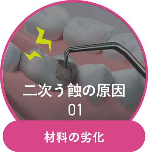 材料の劣化
