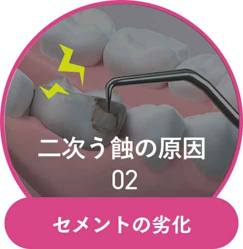 セメントの劣化