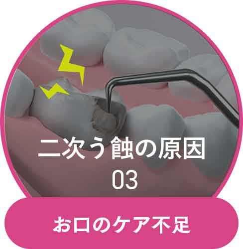 お口のケア不足
