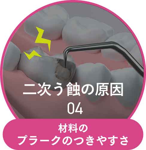 材料のプラークのつきやすさ