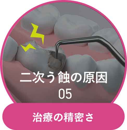 治療の精密さ