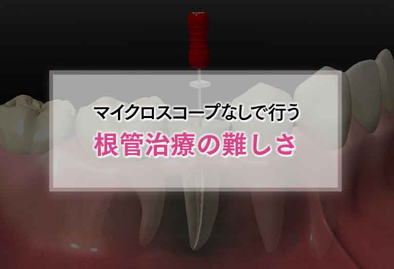 従来の根管治療の成功率