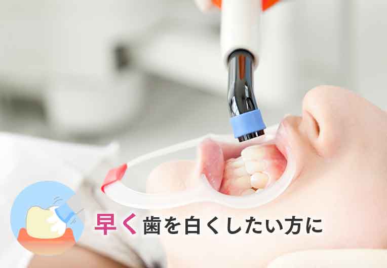 オフィスホワイトニング