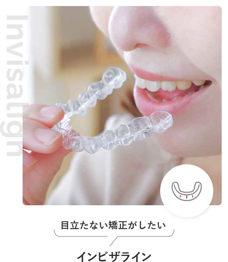 インビザライン