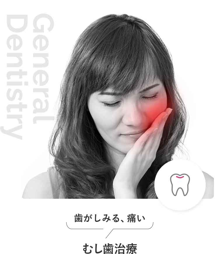 むし歯治療