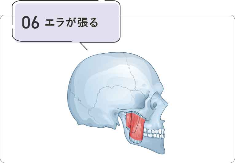 エラが張る