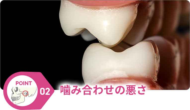 ポイント1
