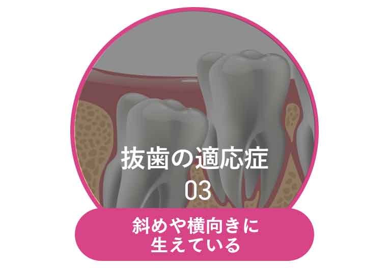 斜めや横向きに生えている