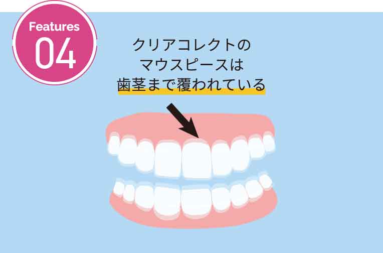 マウスピースに独自の工夫がなされている