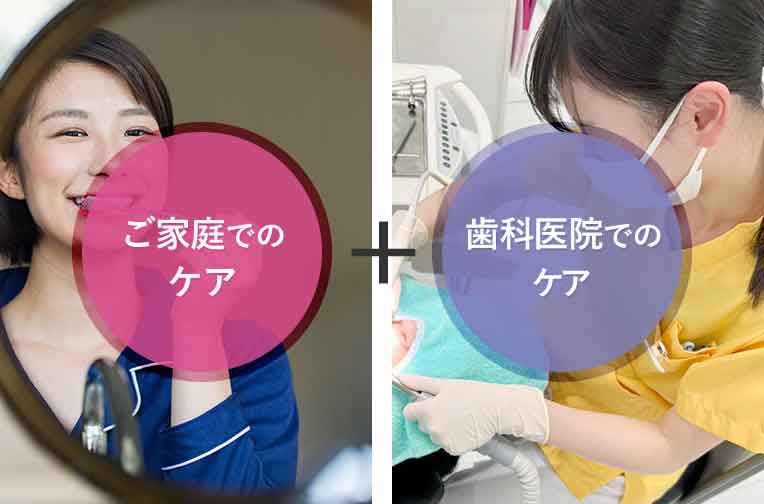 歯周病を予防する方法