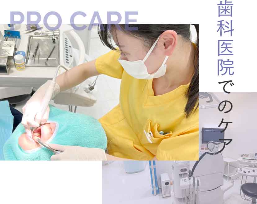 プロケア