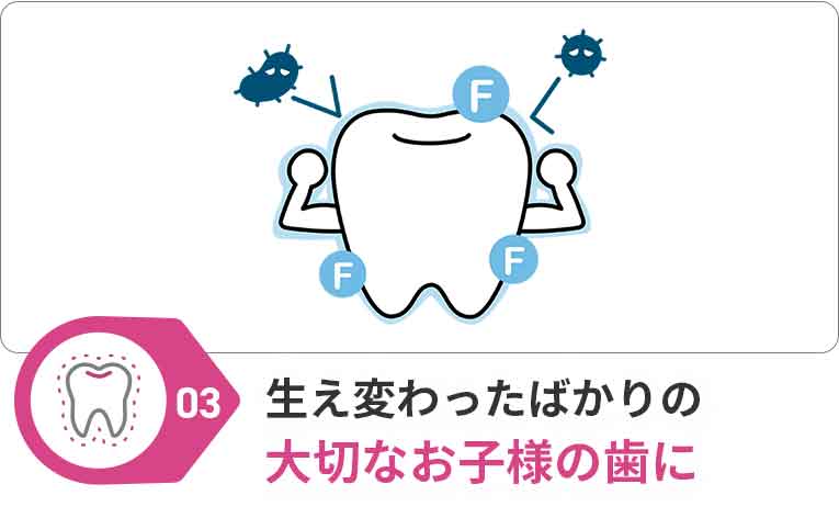フッ素塗布