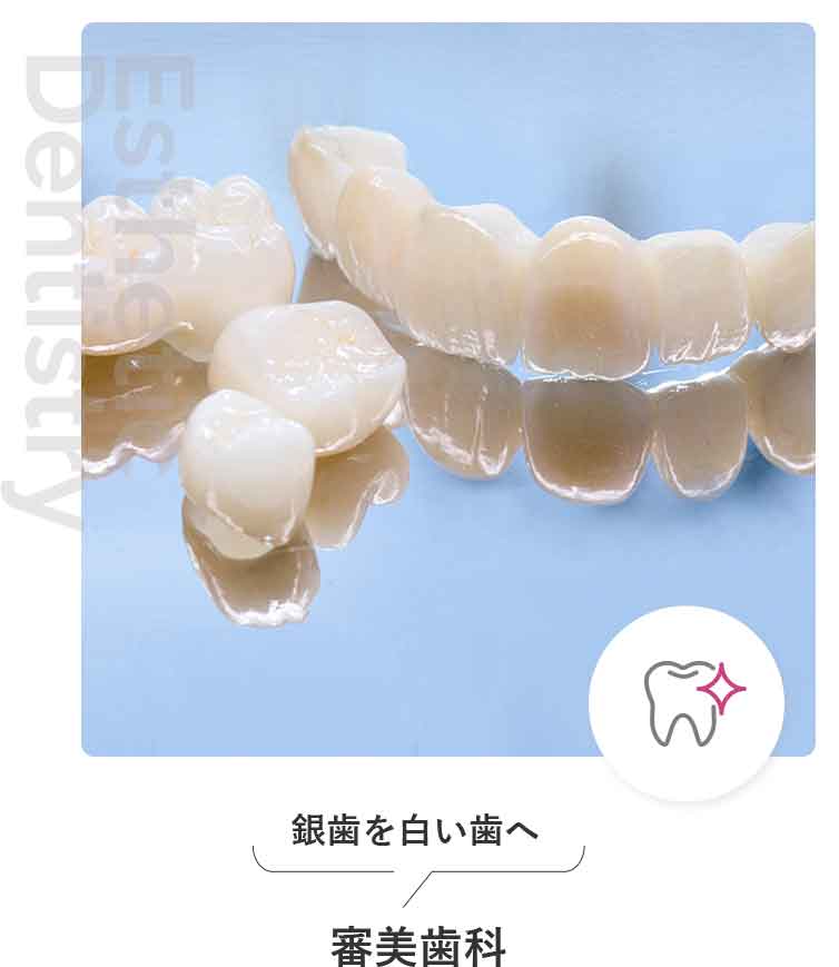 審美歯科