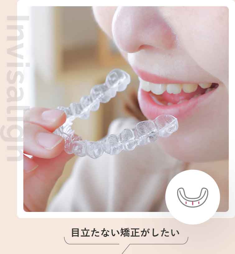 インビザライン®