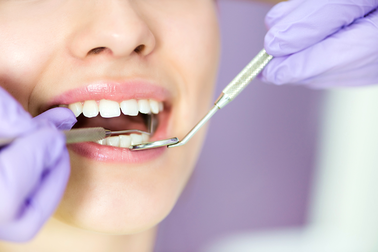 歯の定期検診を受ける女性の口元