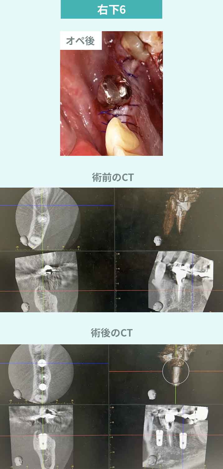 症例