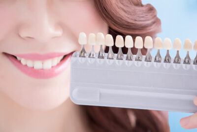 whitening_treatment_01