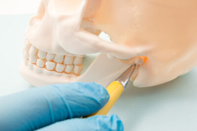 temporomandibular_disorders_02