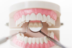 cleaning_perio_01